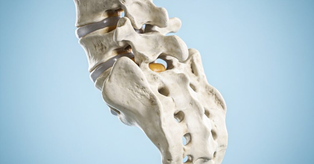 Symptoms of broken neck: Signs, cervical fracture, and long-term effects