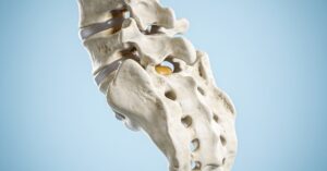 Symptoms of broken neck: Signs, cervical fracture, and long-term effects