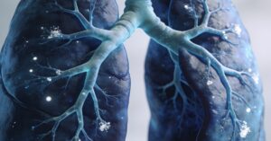 What is a respiratory medicine? A Guide to Lung Health and Care