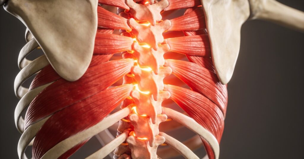 Spinal erectors exercise: Best moves to strengthen your posture