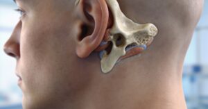 Treatment for mastoiditis: Effective Medical Care and Recovery Options